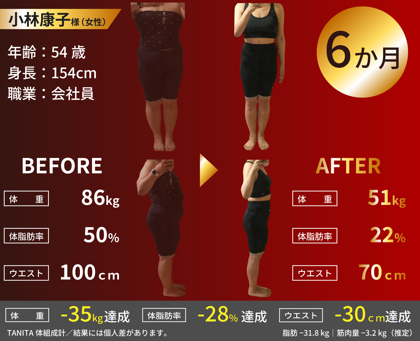 小林康子様（女性・54歳）6か月で体重86kg→51kg・体脂肪率50%→22%・ウエスト100cm→70cm